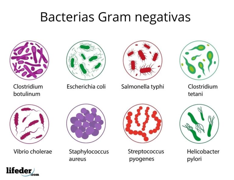 Gram negativas características estructura ejemplos