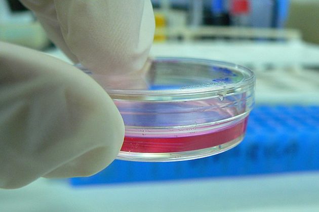 Petri Dish Characteristics Functions Examples Of Use ChemistryRack