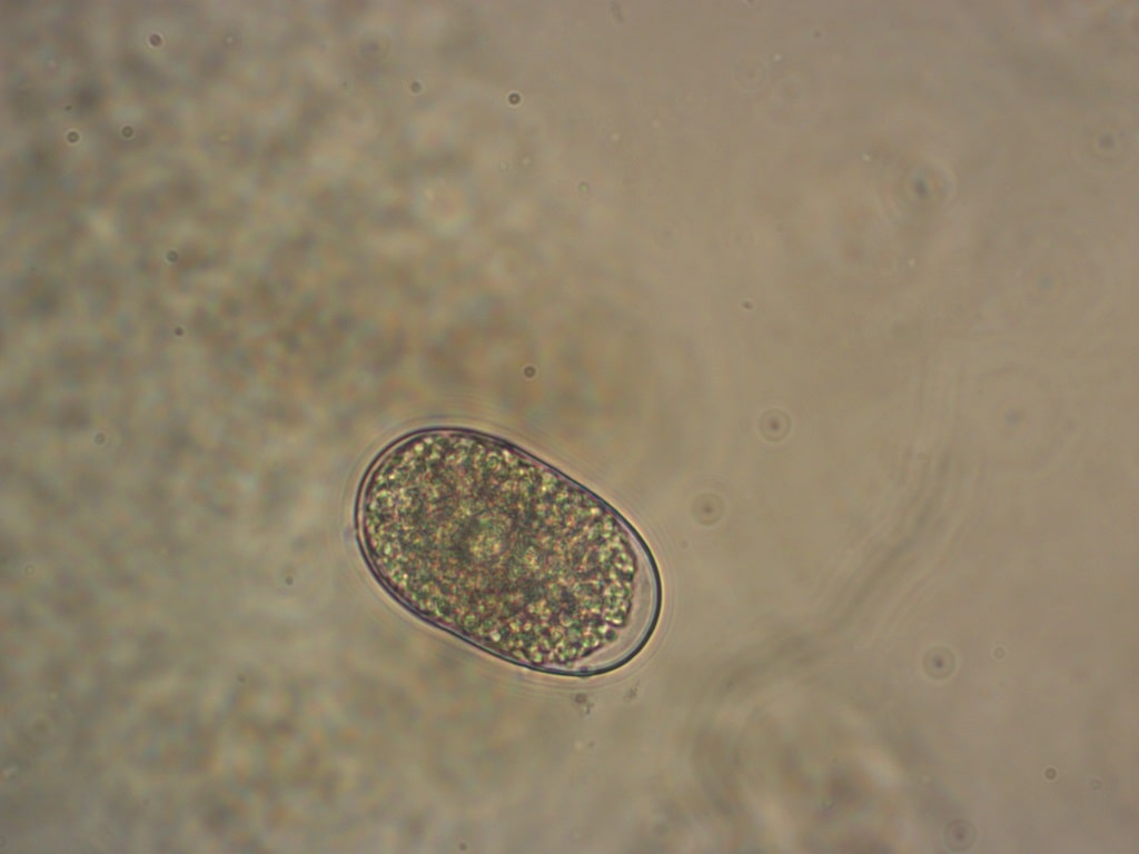 huevo de ancylostoma duodenale