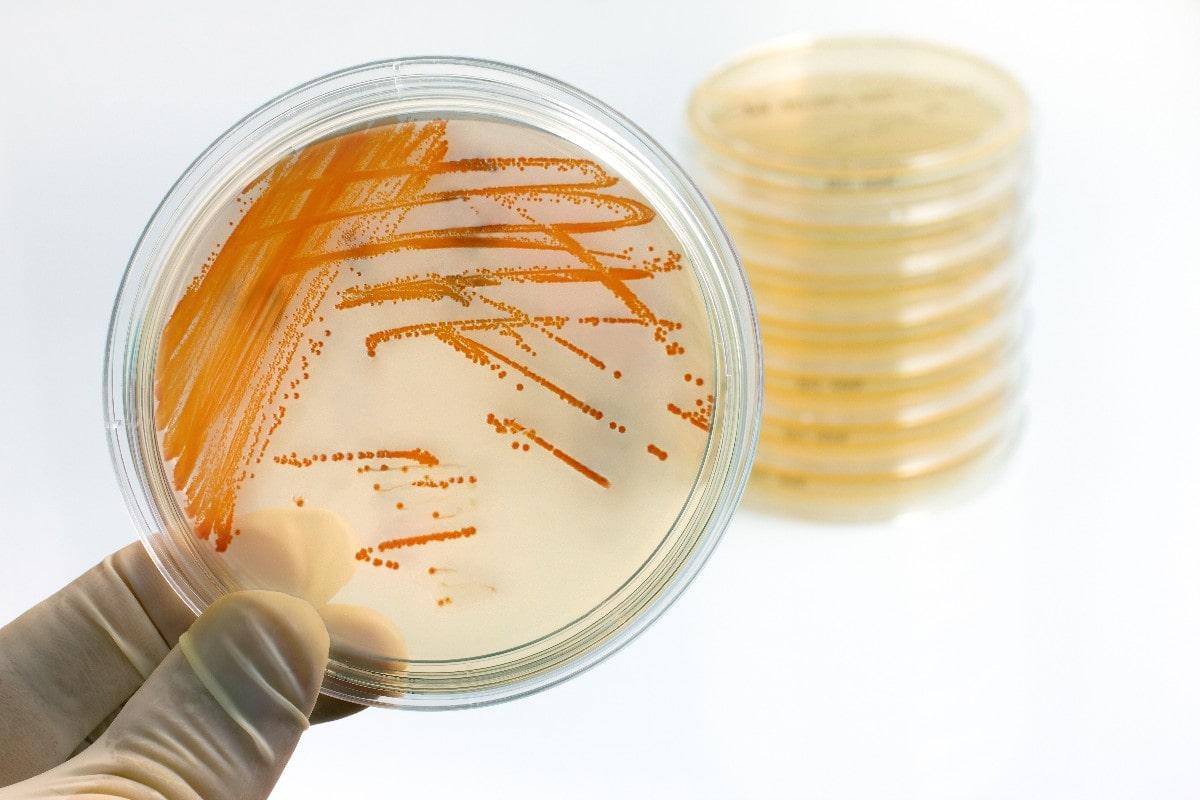 Streptococcus Agalactiae: Qué Es, Características, Morfología, Patogenia