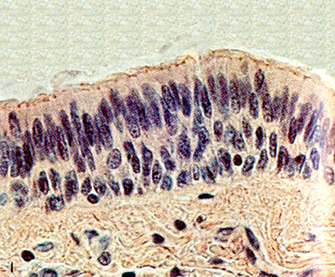 Epitelio Cilindrico Estratificado