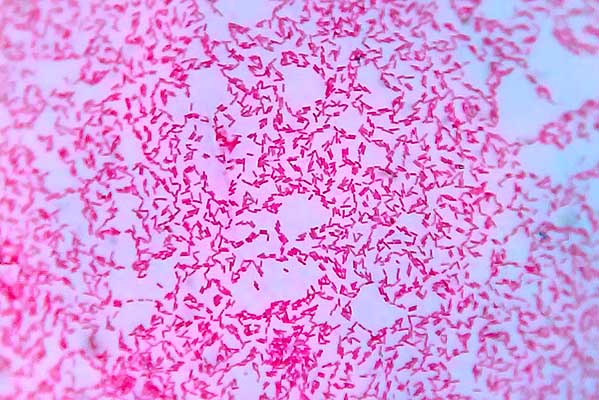 Bacterias Gram negativas: características, estructura, enfermedades ...