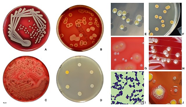 Morfologia De Las Colonias Bacterianas Ajore